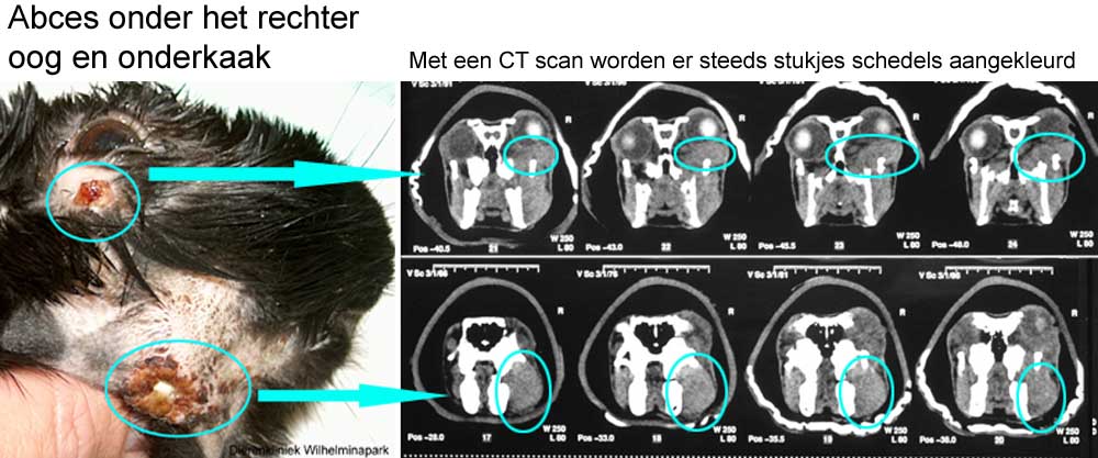 Een CT scan is een doorsnede op steeds verschllende lengtes dor de schedel